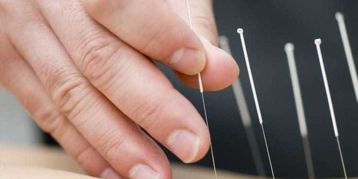 Acupuncture Needles Market Overview, Growth, and Research Report 2024-2032