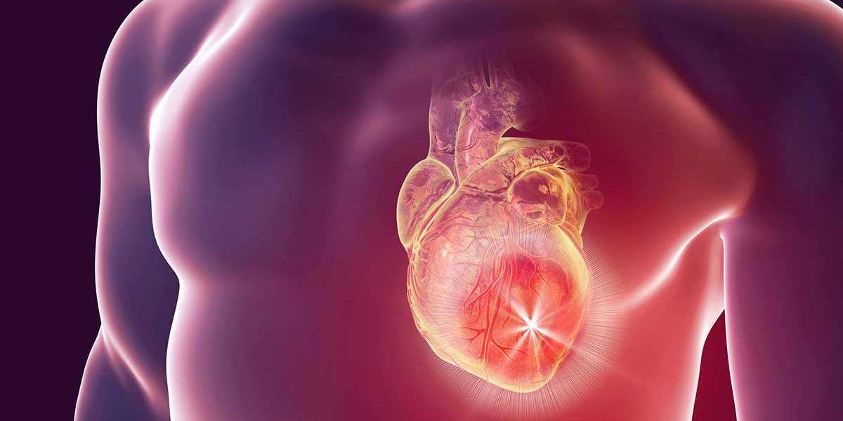 Latest 2024 "Chronic Heart Failure Market" Report & Forecast by 2034