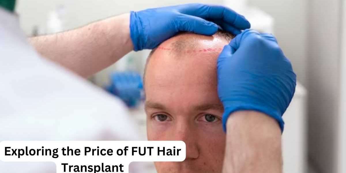 Exploring the FUT Hair Transplant Timeline