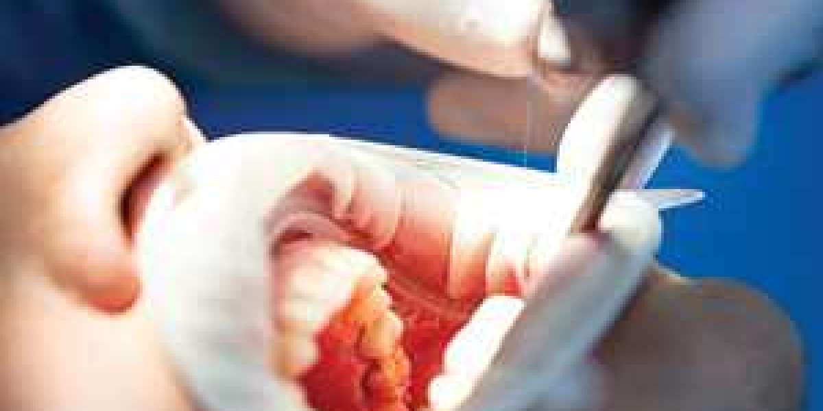 Dental Treatments - Dental Clinic in South Delhi