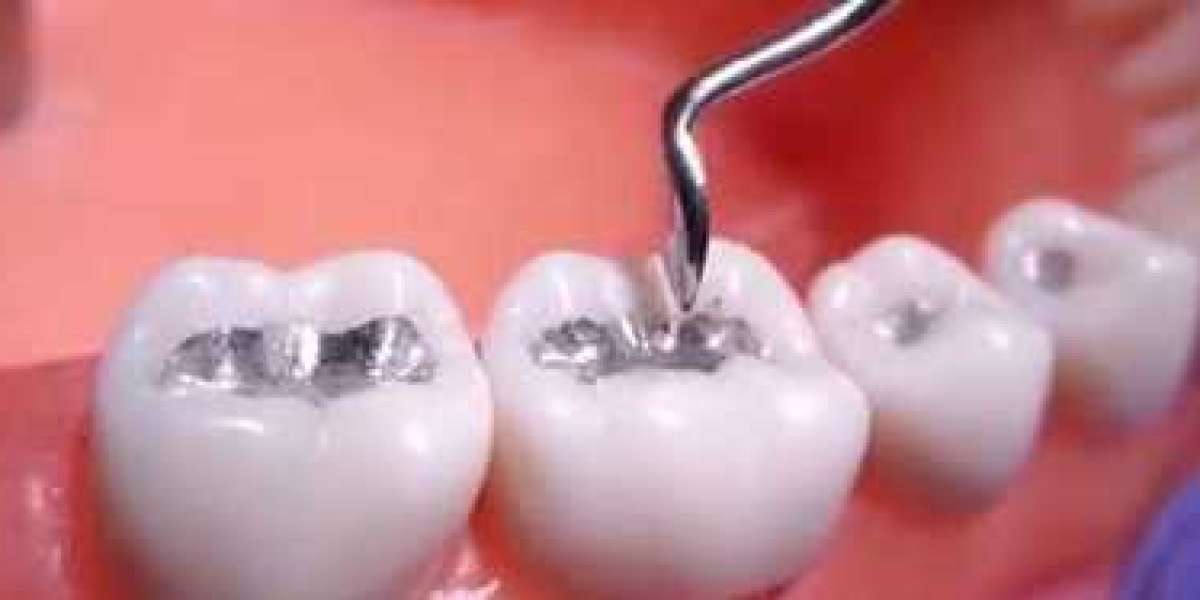 Restorative Dentistry Market to Make Great Impact in Near Future by 2030