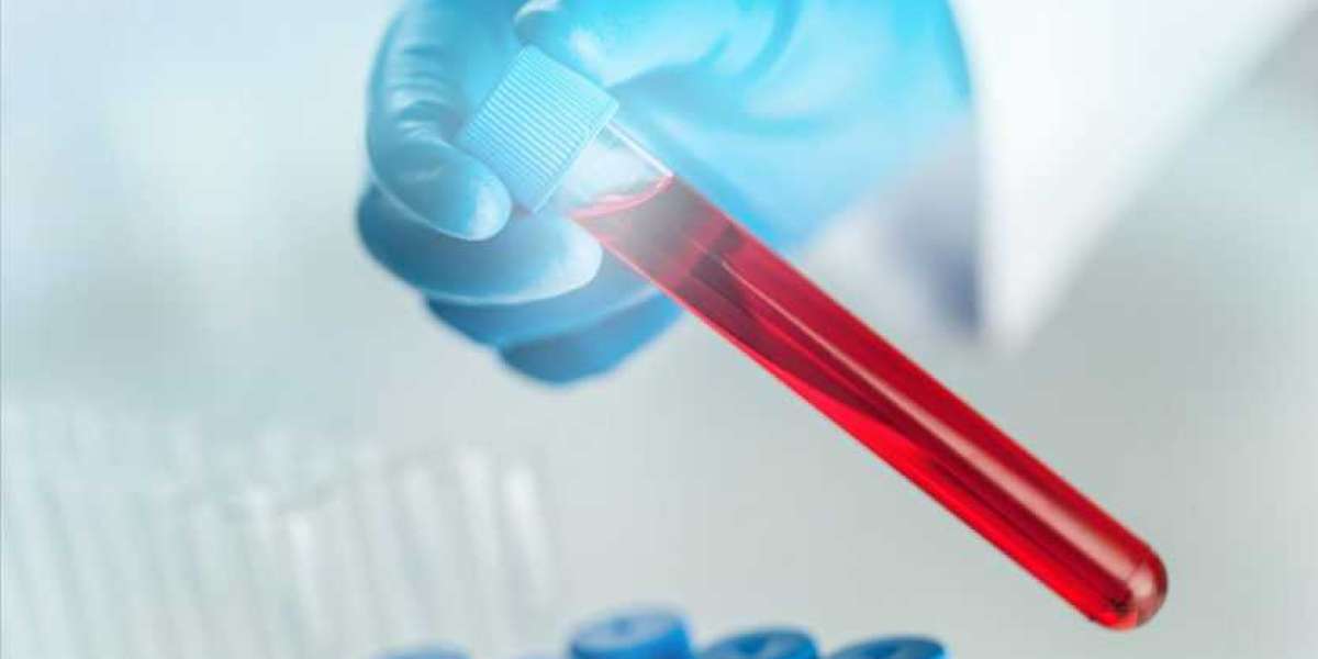 Liquid Biopsy Market Segment and Industry Growth by Forecast to 2027