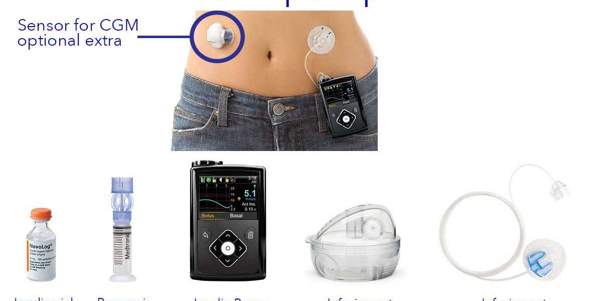 Innovative Solutions for Diabetes: An Insider's Look at Top Insulin Pump Manufacturers