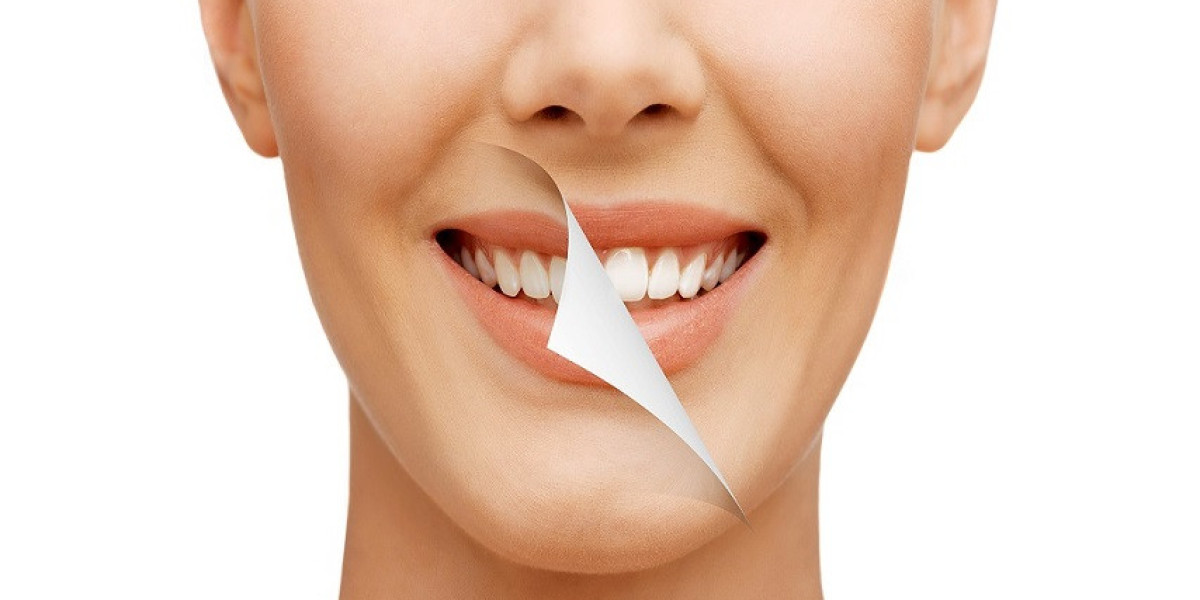 Get A Beautiful Smile With Teeth Whitening Services