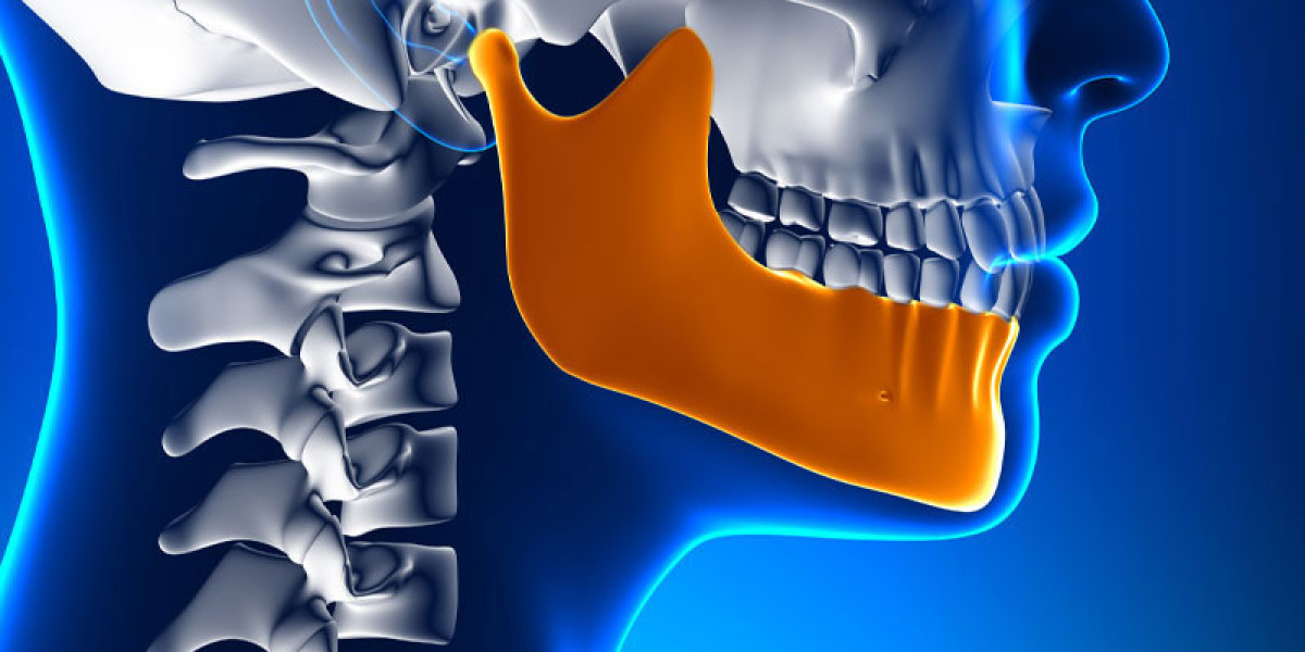 Beyond Traditional Treatments: Exploring the Rise of TMJ Implants in Oral Healthcare