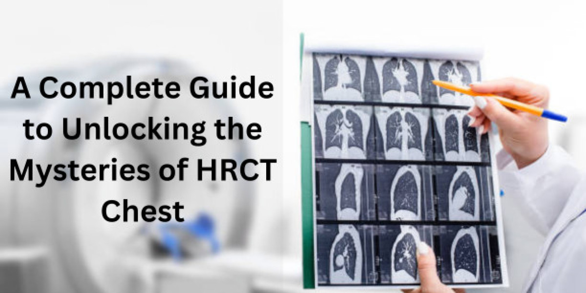 A Complete Guide to Unlocking the Mysteries of HRCT Chest
