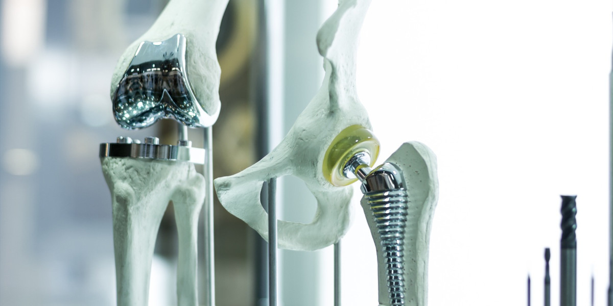 Joint Replacement Revolution: Biomaterials Take Center Stage in the Americas