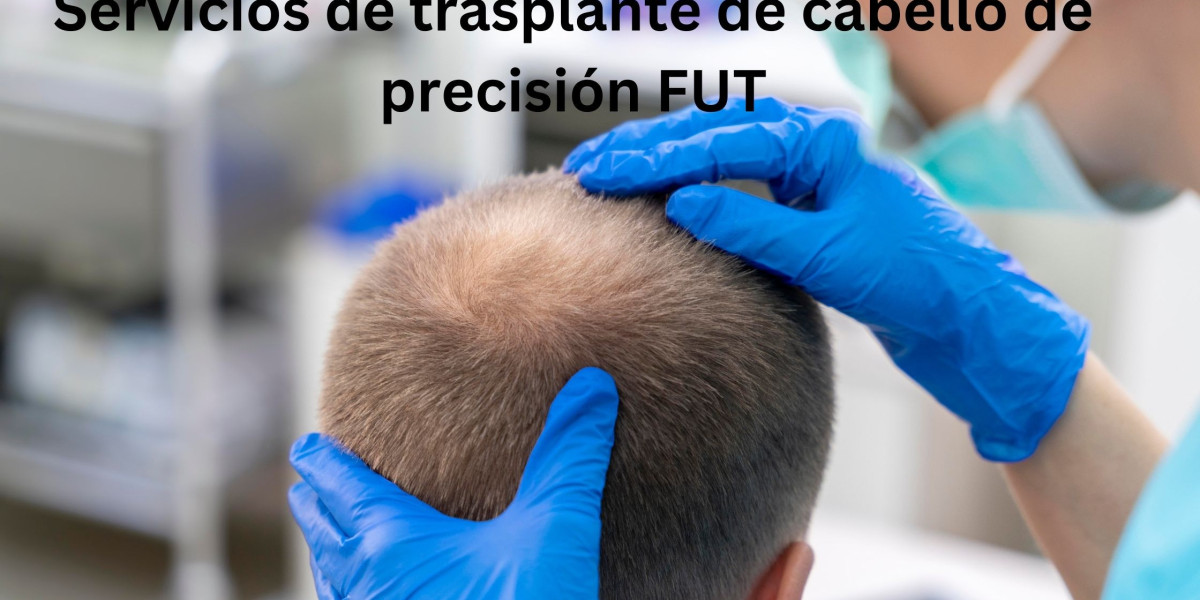 Servicios de trasplante de cabello de precisión FUT