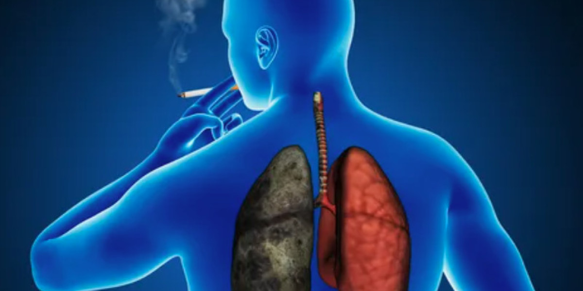 Lung Cancer Therapy Market Share, Trend, Segmentation And Forecast 2030