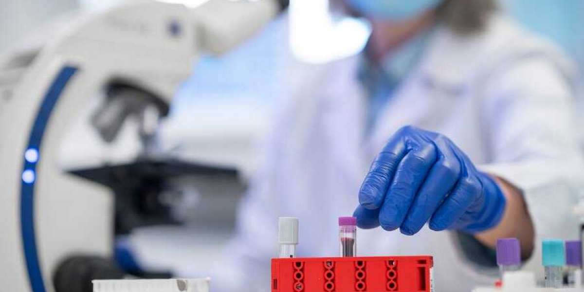 Blood Culture Pathology Tests Market: Navigating Trends and Transformative Innovations