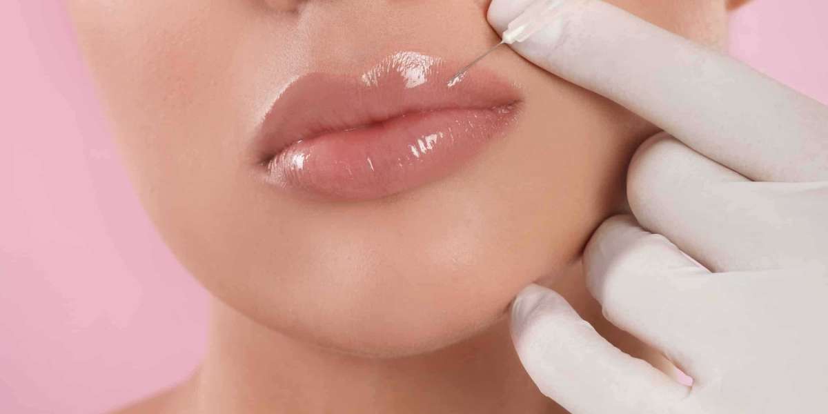 Enhancing Expressions: The Subtle Artistry of Lip Filler Applications