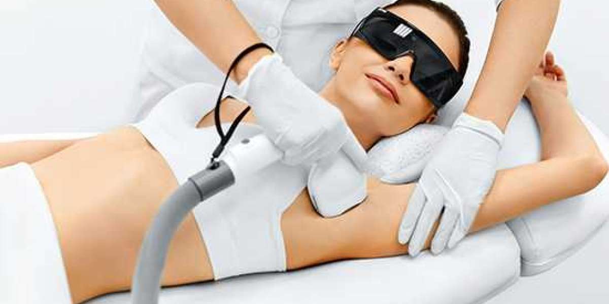 The Benefits of Laser Hair Removal in Kristiansand