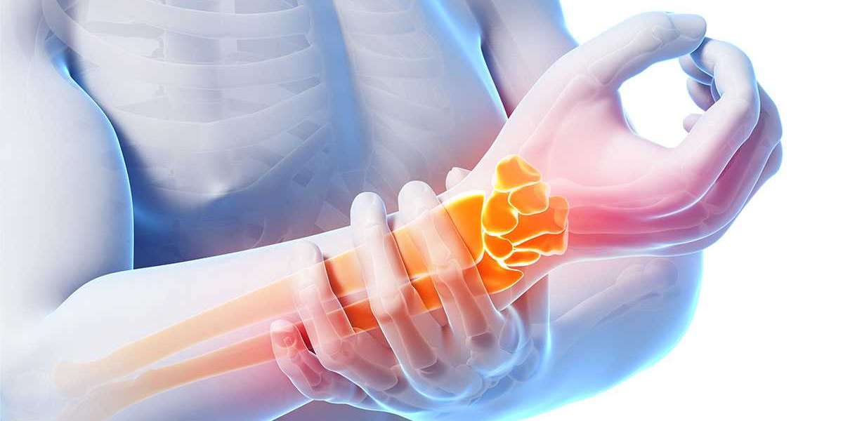 Chiropractic Beneficial for Carpal Tunnel.