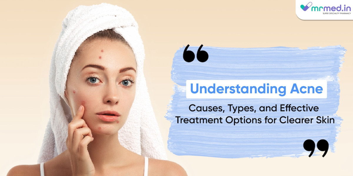 Understanding Acne: Causes, Types, and Effective Treatment Options for Clearer Skin