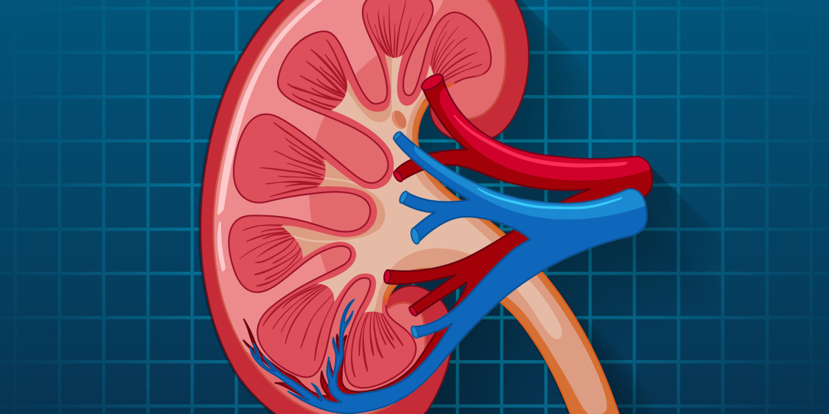 Kidney Transplant: A Quick Guide