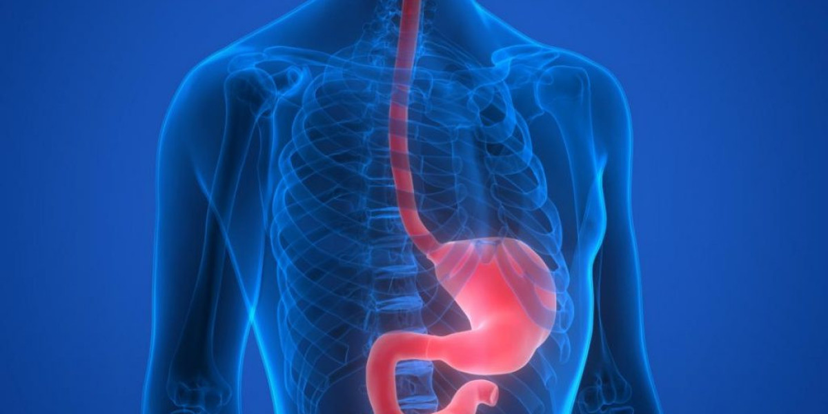Navigating the Global Barrett’s Esophagus Market: Trends and Analysis