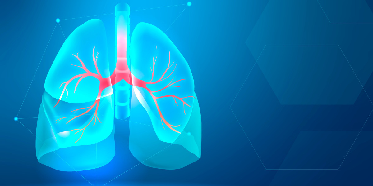 Lung Cancer – The most frequently asked questions