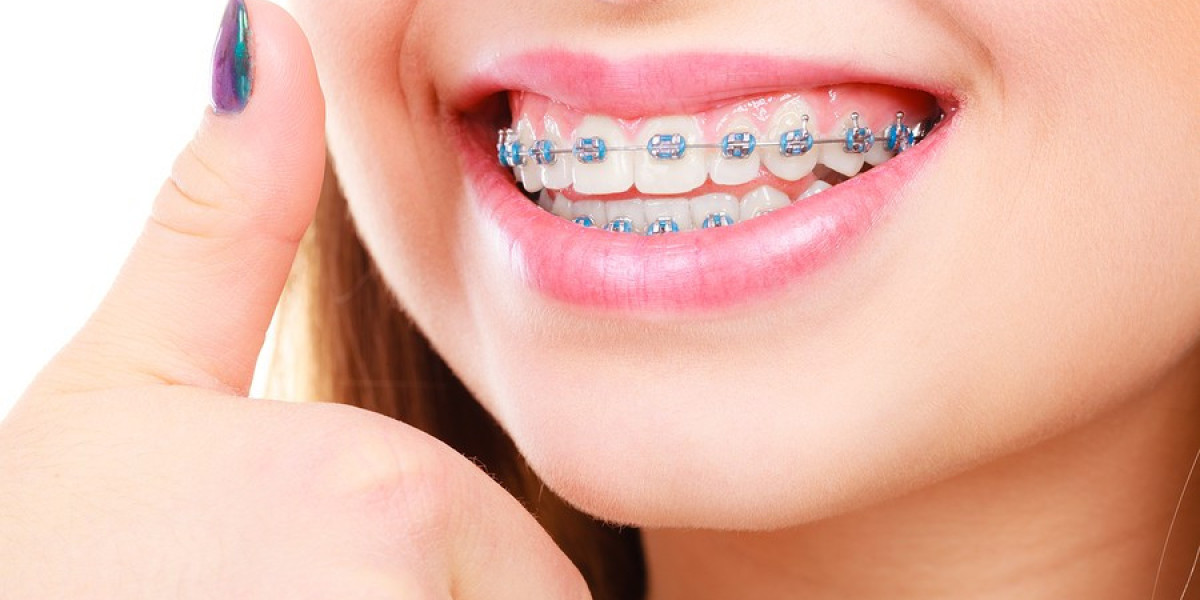 Global Orthodontic Brackets Market is Estimated to Witness High Growth Owing to Digitalization