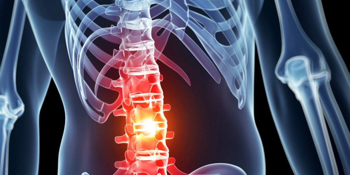 Exploring the World of Spinal Imaging: Understanding the Role of Spinal Imaging in Healthcare