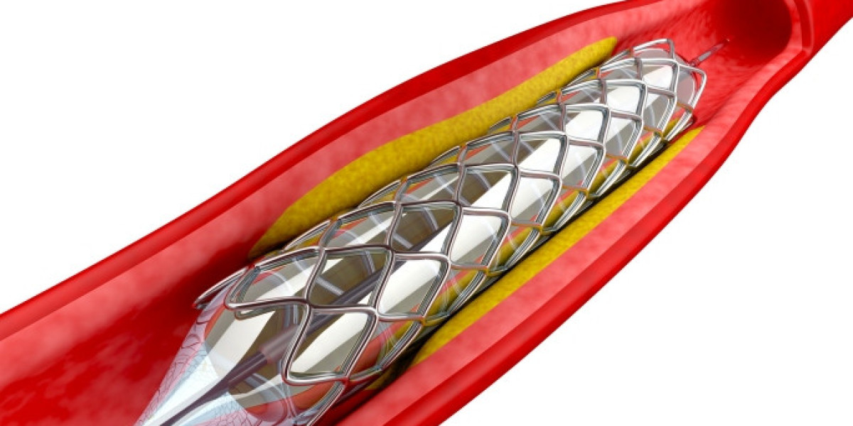 Angioplasty Balloons Market Analysis, Opportunities, Future Growth and Business Prospects