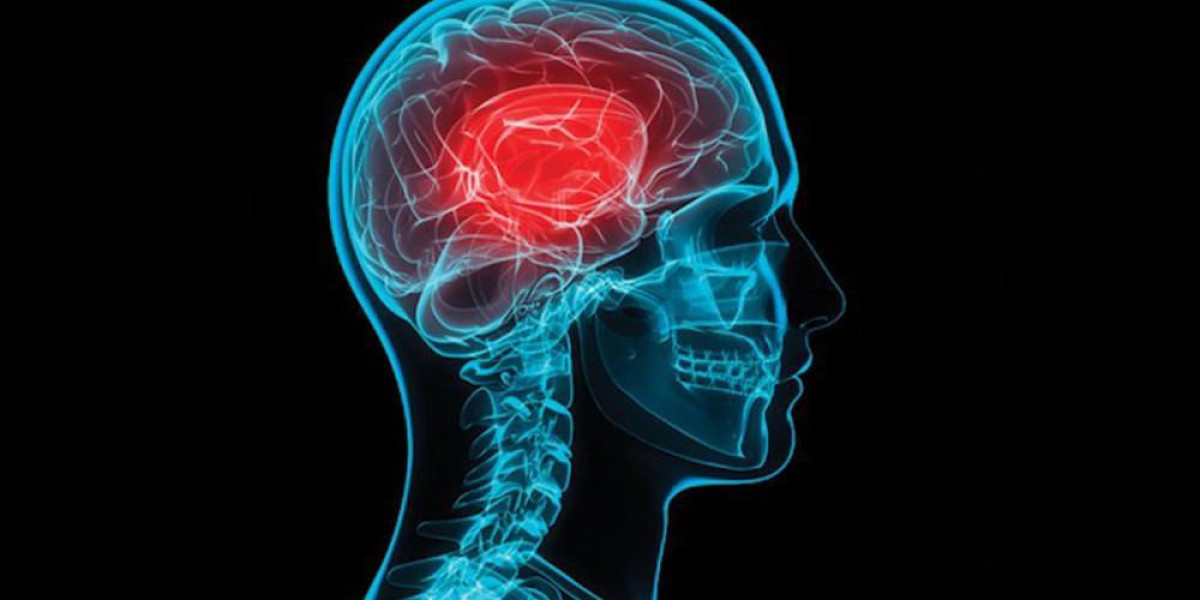 Concussions Market Size, Trends And Forecast To 2034