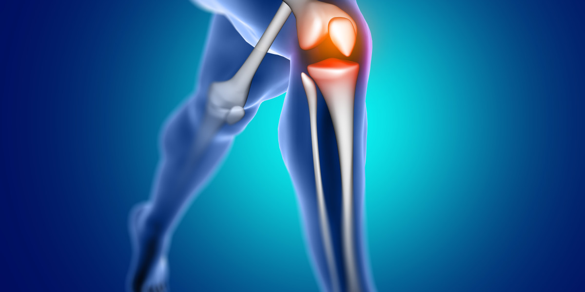Your 10-Minute Guide to Knee Replacement Surgery