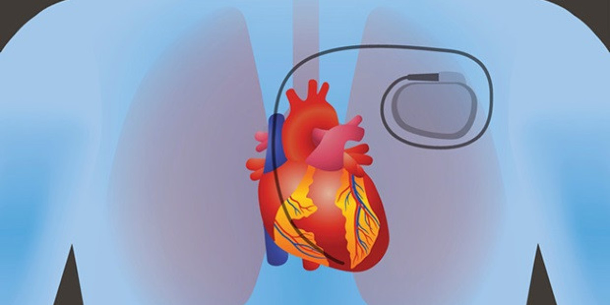 Cardiac Pacemaker Market Evolution: Historical Review