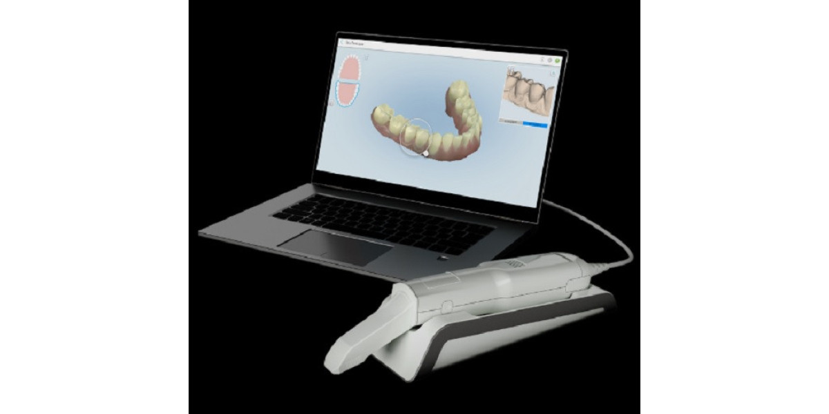Navigating the Market: Essential Tips for Shopping for Intraoral Scanners