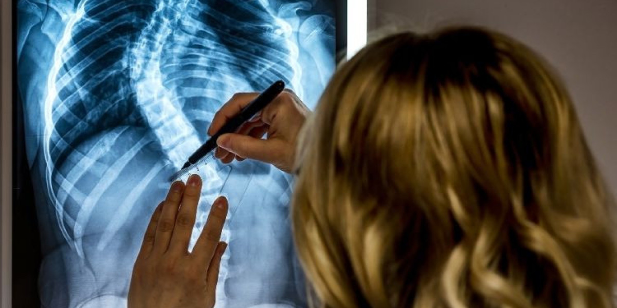 Asia Pacific Scoliosis Management Market: A Look at Current Trends and Future Directions