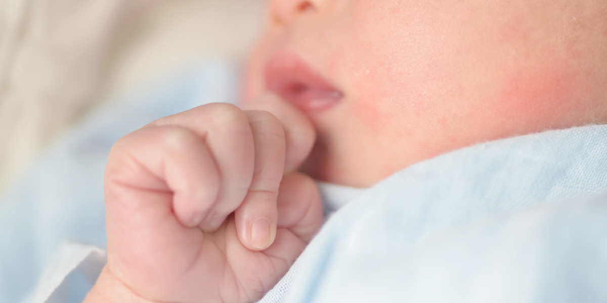 Newborn Jaundice: A Brief Guide
