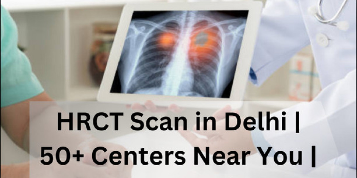 HRCT Scan in Delhi | 50+ Centers Near You | Compare Prices: A Comprehensive Guide
