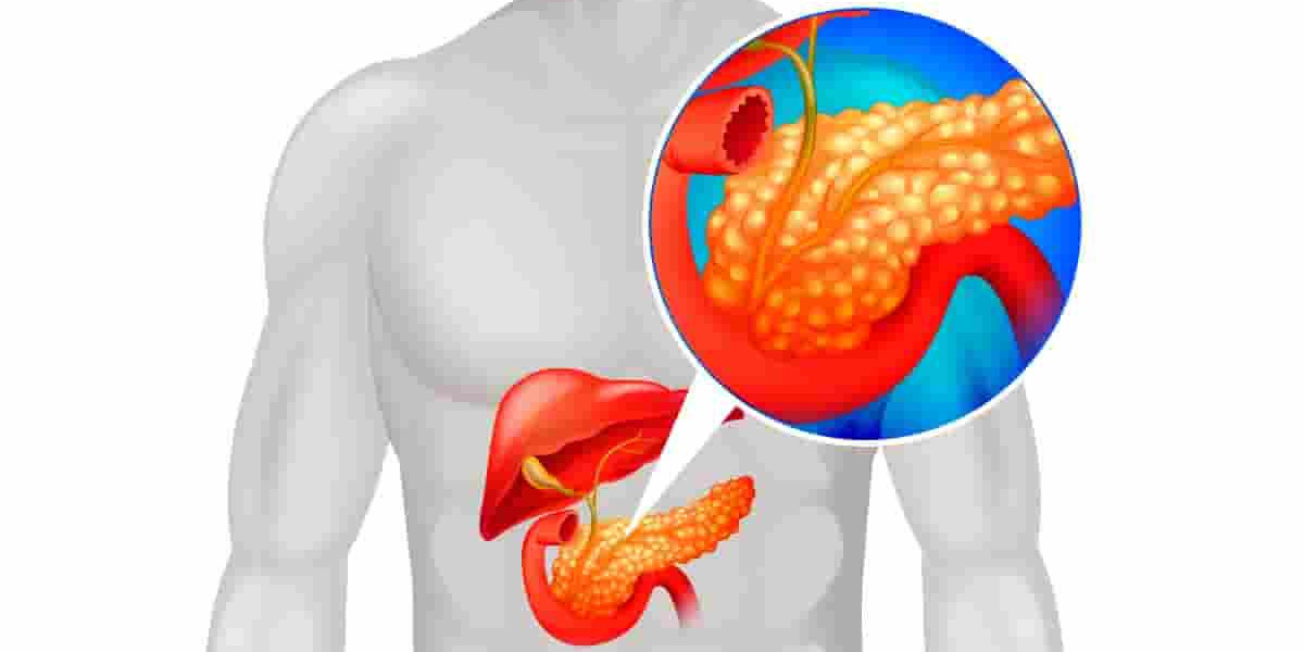 Acute Pancreatitis Market SWOT Analysis and Growth by Forecast by 2030