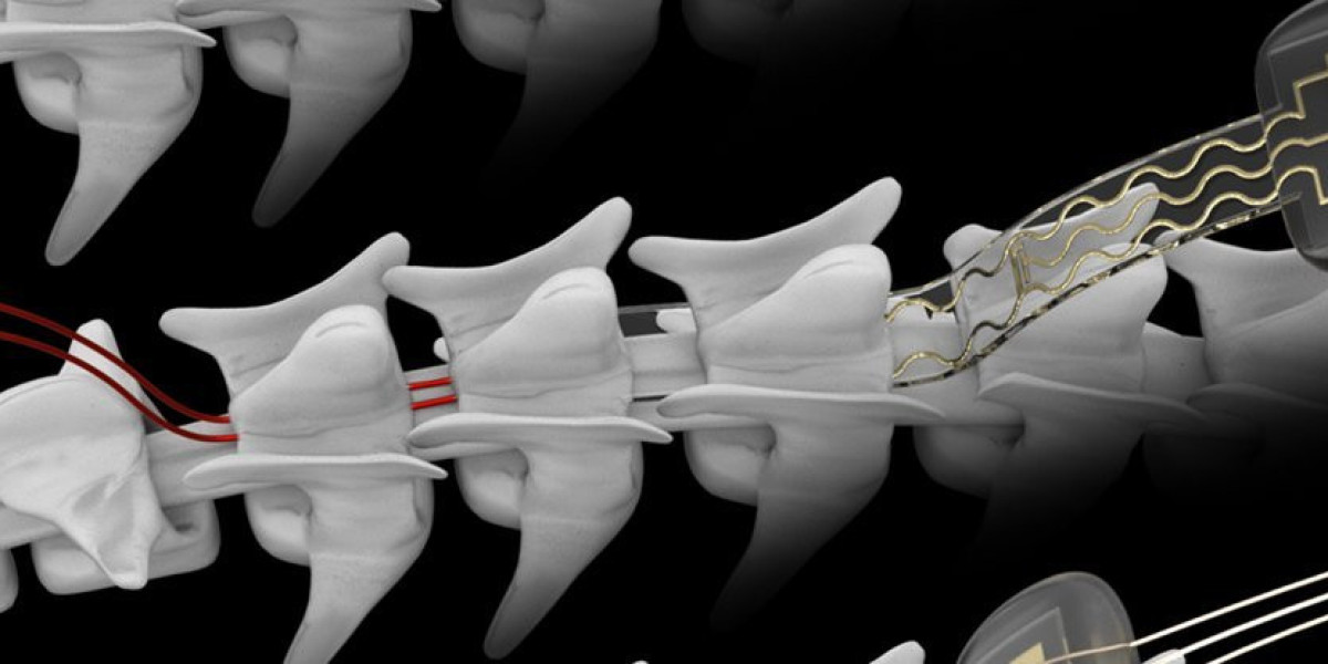 Radial Head Resection Implants: Enhancing Mobility and Functionality
