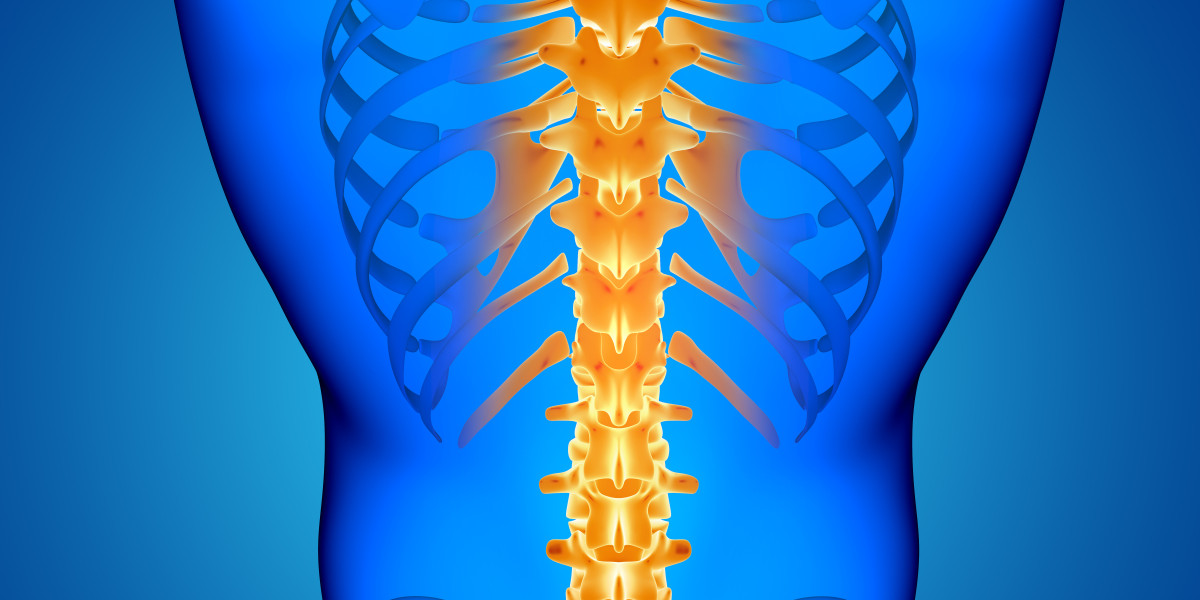 Kyphosis: What you should know