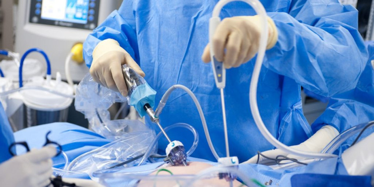 Understanding the Role of Laparoscopic Electrodes in Modern Surgery