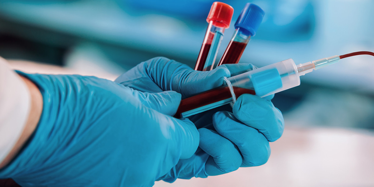 Blood Viscometers Market Trends and Industry Growth Forecast by 2031