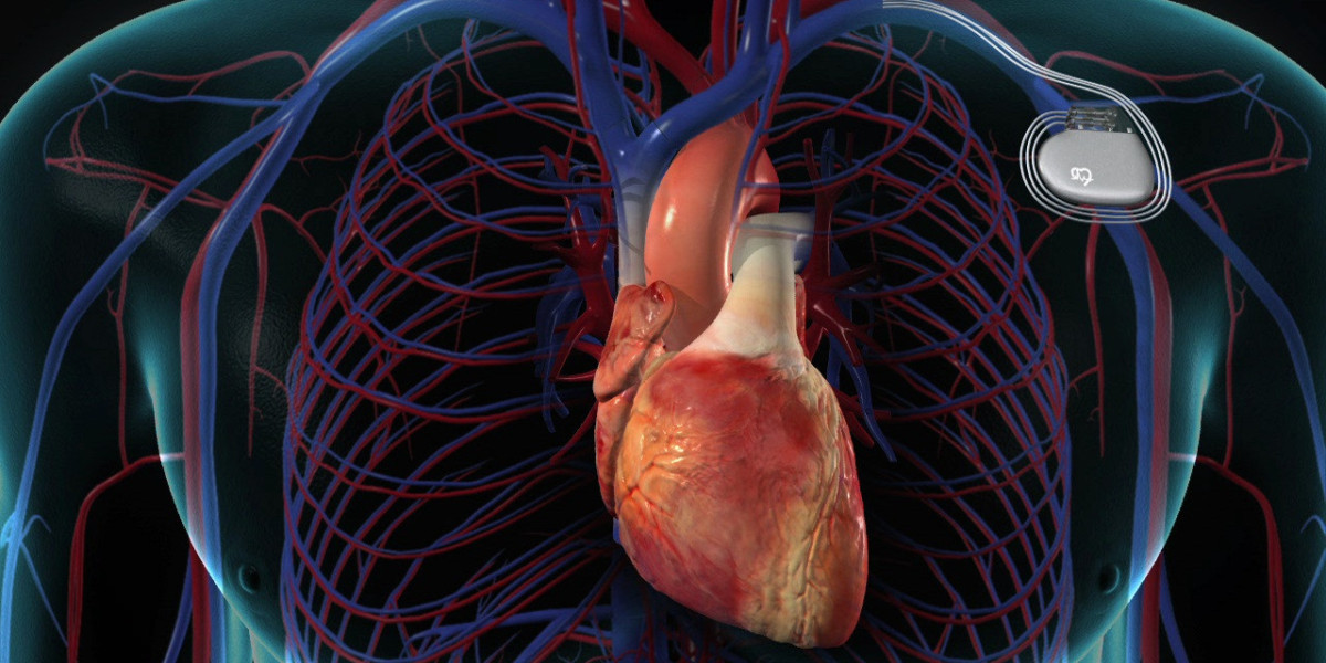 Cardiac Pacemaker Market: Sales Channels and Distribution Strategies