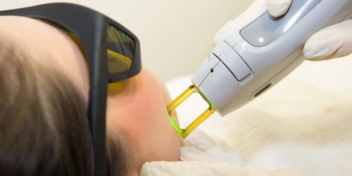 Laser Hair Removal Market Trends, Share, Size and Forecast to 2030