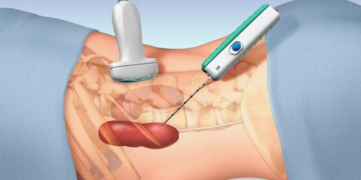 Needle Biopsy Market Analysis, Value Share and Key Trends 2031