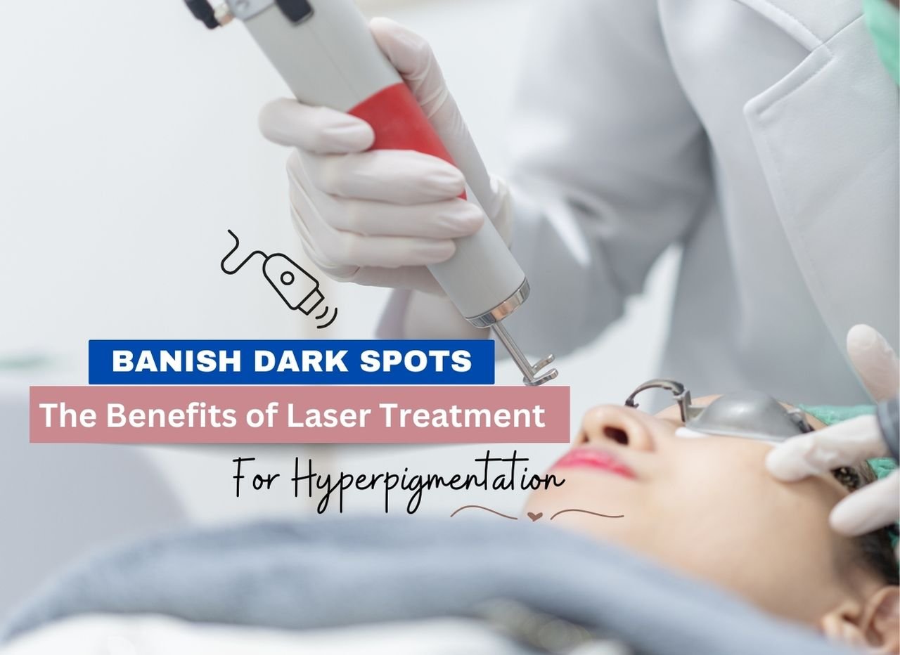 The Benefits of Laser Treatment for Hyperpigmentation | Truly Permanent Beauty
