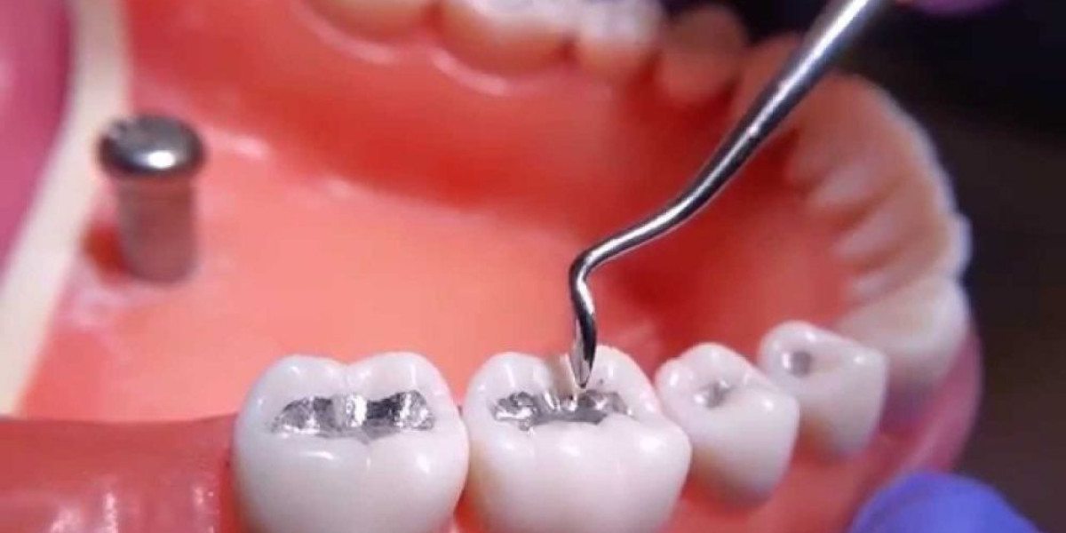 Dental Amalgam Separator Market driven by stringent regulatory norms in dental industry