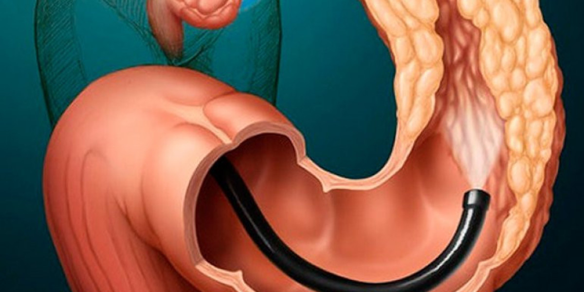The Role of Colonoscopy Bowel Preparation Drugs in Gastrointestinal Health