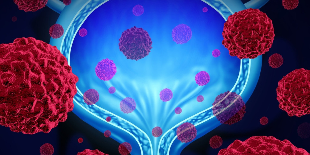Urothelial Cancer Treatment Market Forecast, Analysis | Reports and Insights | 2024-2032