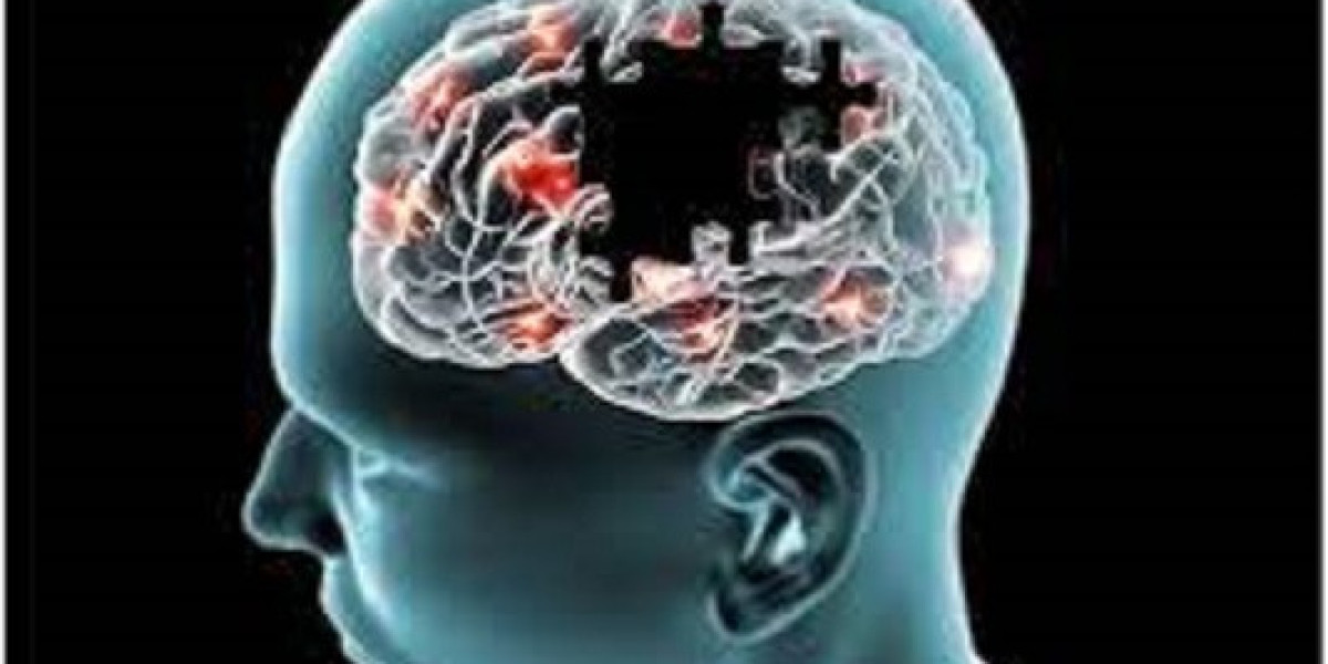 Alzheimer’s Disease Market Research | 2024-2034