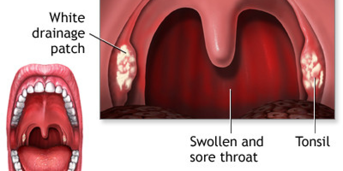 Finding Best Throat Specialist in Mumbai, India : Dr. Meenesh Juvekar