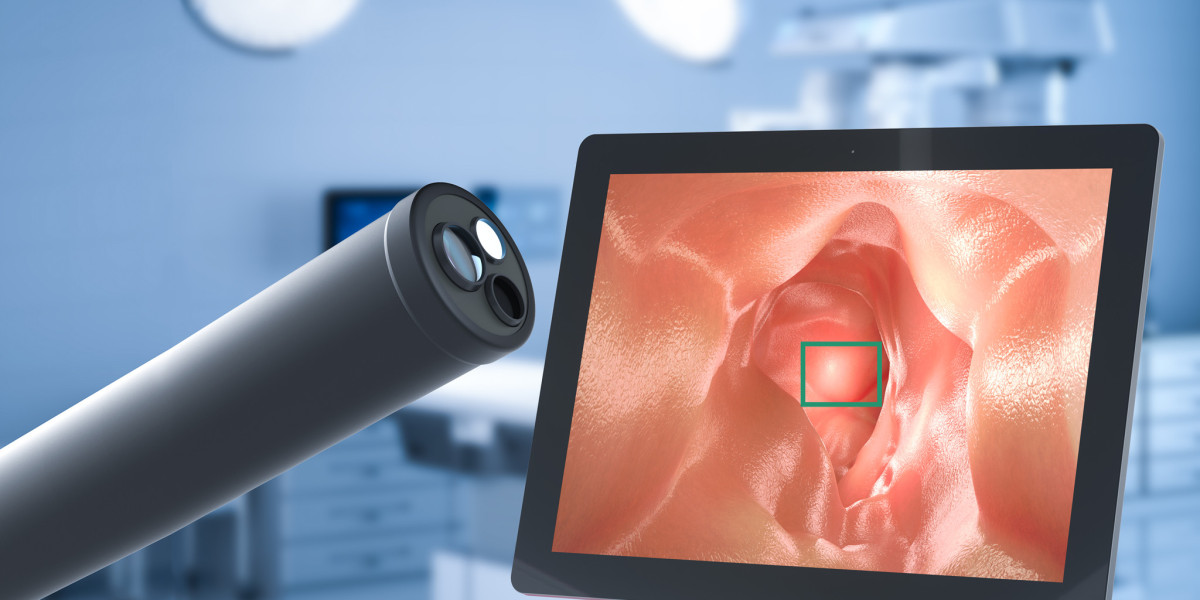 AI in Endoscopy Market Size, In-depth Analysis Report and Global Forecast to 2032