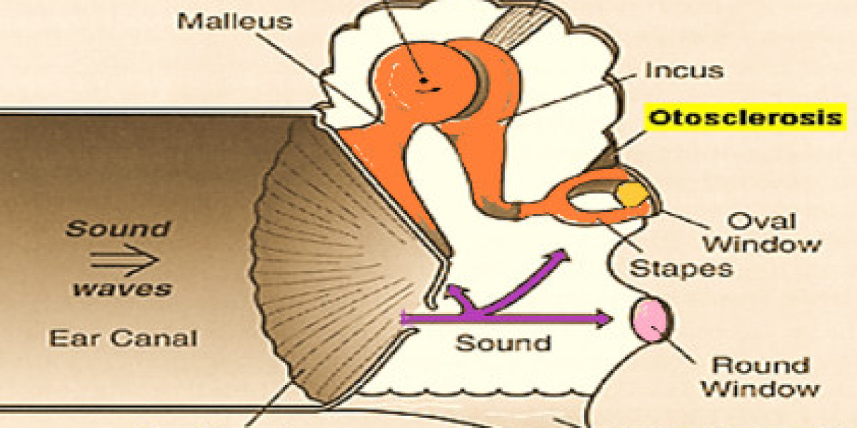 Dr. Meenesh Juvekar: Advancing Cochlear Implant Surgery for Congenital Hearing Loss