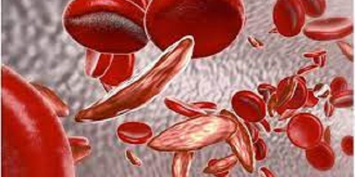 2024, Sickle Cell Disease Market | Industry Analysis Till 2034