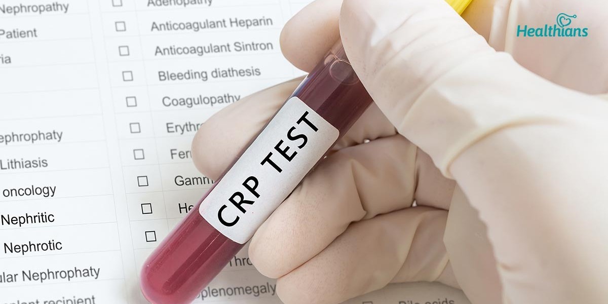 Understanding the CRP Blood Test