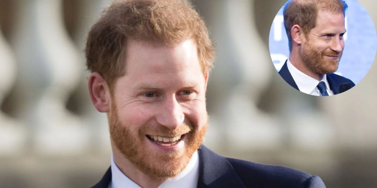 Prince Harry Bald? The Royal Hair Mystery Unveiled!